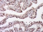 ZNF22 Antibody in Immunohistochemistry (Paraffin) (IHC (P))
