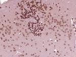 ZNF496 Antibody in Immunohistochemistry (Paraffin) (IHC (P))