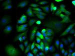 XIAP/BIRC4 Antibody in Immunocytochemistry (ICC/IF)