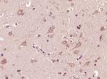 STK11IP Antibody in Immunohistochemistry (Paraffin) (IHC (P))