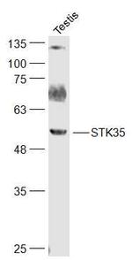 STK35 Antibody in Western Blot (WB)