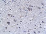 BAK Antibody in Immunohistochemistry (Paraffin) (IHC (P))