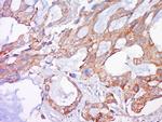 BAK Antibody in Immunohistochemistry (Paraffin) (IHC (P))