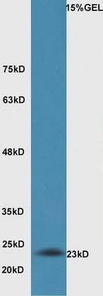 BAK Antibody in Western Blot (WB)