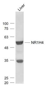 Bile Acid Receptor NR1H4 Antibody in Western Blot (WB)