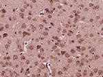 BRAF35 Antibody in Immunohistochemistry (Paraffin) (IHC (P))