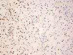 Phospho-c-Fos (Ser362) Antibody in Immunohistochemistry (Paraffin) (IHC (P))