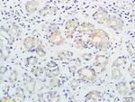 ING1/p33ING1b Antibody in Immunohistochemistry (Paraffin) (IHC (P))