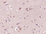 CTRP2 Antibody in Immunohistochemistry (Paraffin) (IHC (P))