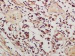 Phospho-CSK (Ser364) Antibody in Immunohistochemistry (Paraffin) (IHC (P))