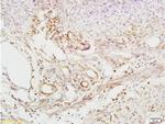 Defensin beta 2/DEFB2/HBD-2 Antibody in Immunohistochemistry (Paraffin) (IHC (P))