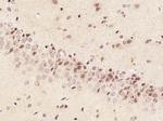 Phospho-alpha B Crystallin (Ser59) Antibody in Immunohistochemistry (Paraffin) (IHC (P))