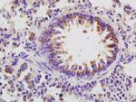 beta defensin 2 Antibody in Immunohistochemistry (Paraffin) (IHC (P))