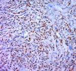Phospho-DAXX (Ser668) Antibody in Immunohistochemistry (Paraffin) (IHC (P))