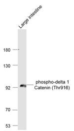 Phospho-delta 1 Catenin (Thr916) Antibody in Western Blot (WB)