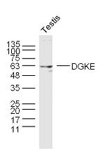 DGKE Antibody in Western Blot (WB)
