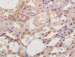 DIAPH2/Dia2 Antibody in Immunohistochemistry (Paraffin) (IHC (P))
