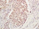 DNA Polymerase gamma Antibody in Immunohistochemistry (Paraffin) (IHC (P))