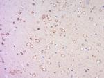 DNA Polymerase iota Antibody in Immunohistochemistry (Paraffin) (IHC (P))