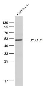 DYX1C1 Antibody in Western Blot (WB)