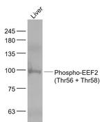 Phospho-EEF2 (Thr56, Thr58) Antibody in Western Blot (WB)