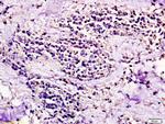 CCR7/CD197 Antibody in Immunohistochemistry (Paraffin) (IHC (P))
