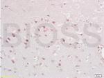 XAF1 Antibody in Immunohistochemistry (Paraffin) (IHC (P))