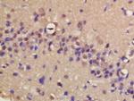 ERCC8/CSA Antibody in Immunohistochemistry (Paraffin) (IHC (P))