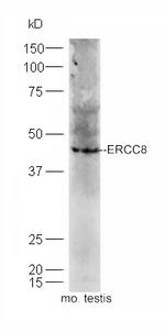 ERCC8/CSA Antibody in Western Blot (WB)