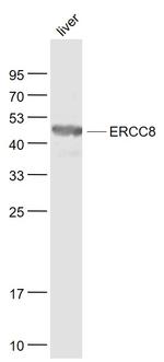 ERCC8/CSA Antibody in Western Blot (WB)