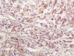 EPS15R Antibody in Immunohistochemistry (Paraffin) (IHC (P))