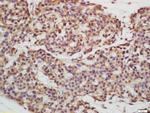 EPS15R Antibody in Immunohistochemistry (Paraffin) (IHC (P))
