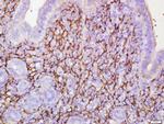 ETL/ELTD1 Antibody in Immunohistochemistry (Paraffin) (IHC (P))