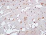 EXOC2/SEC5 Antibody in Immunohistochemistry (Paraffin) (IHC (P))