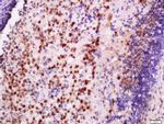 EXOSC10/PMSCL2 Antibody in Immunohistochemistry (Paraffin) (IHC (P))