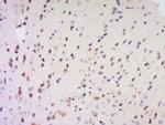 EXOSC7 Antibody in Immunohistochemistry (Paraffin) (IHC (P))