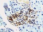 IGF2BP3 Antibody in Immunohistochemistry (Paraffin) (IHC (P))