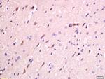 FAM134B Antibody in Immunohistochemistry (Paraffin) (IHC (P))