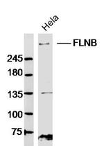 FLNB/Filamin 3 Antibody in Western Blot (WB)