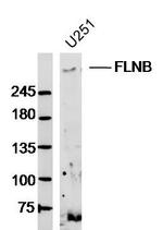 FLNB/Filamin 3 Antibody in Western Blot (WB)