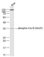 Phospho-FosB (Ser27) Antibody in Western Blot (WB)