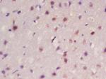 Frizzled 10/CD350 Antibody in Immunohistochemistry (Paraffin) (IHC (P))