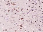 FSD1 Antibody in Immunohistochemistry (Paraffin) (IHC (P))