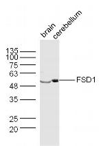 FSD1 Antibody in Western Blot (WB)