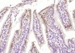 FUBP1/2 Antibody in Immunohistochemistry (Paraffin) (IHC (P))