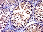 FUSIP1 Antibody in Immunohistochemistry (Paraffin) (IHC (P))