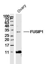 FUSIP1 Antibody in Western Blot (WB)