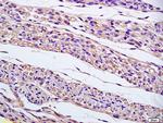 gamma tubulin Centrosome Marker Antibody in Immunohistochemistry (Paraffin) (IHC (P))
