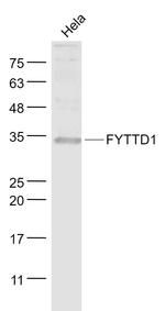FYTTD1 Antibody in Western Blot (WB)