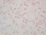FZD3/Frizzled 3 Antibody in Immunohistochemistry (Paraffin) (IHC (P))